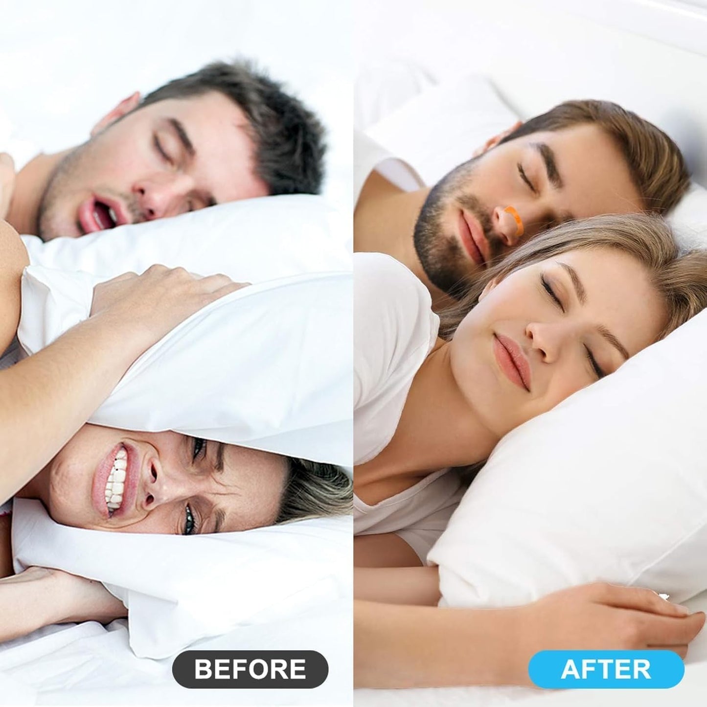Premier Nasal Dilator Starter Kit – Black | Sleep & Sport Nasal Breathing Aid (15-Day Supply)