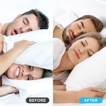 Premier Nasal Dilator Starter Kit – Black | Sleep & Sport Nasal Breathing Aid (15-Day Supply)